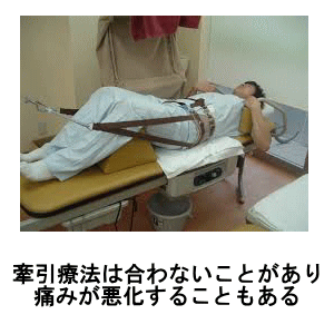 牽引