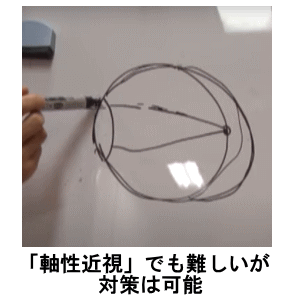 軸性近視、真性近視、眼軸長