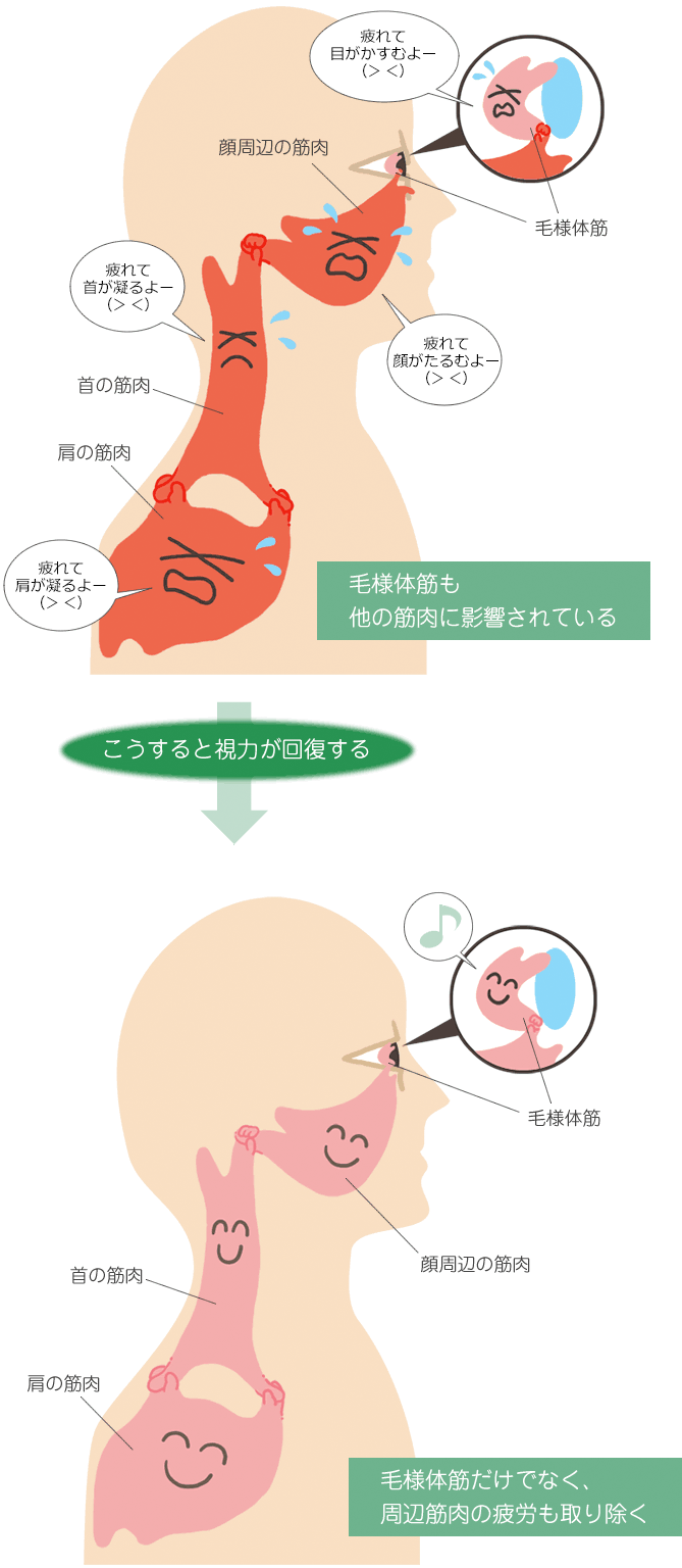 周辺の筋肉を柔軟にすることで視力が回復するイラスト